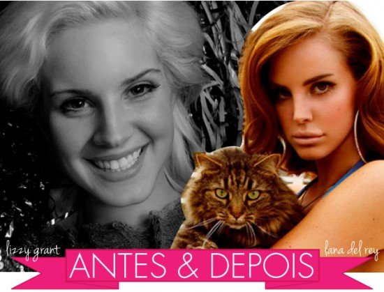 lana-del-rey-lizzy-grant-antes-e-depois-cirurgia-plastica-labios-preenchimento
