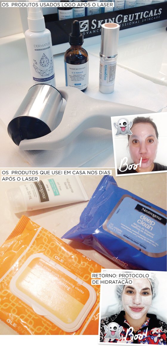 laser-fracionado-diminuir-poros-pele-rosto-dra-vanessa-metz-dermatologista